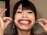 口腔羞恥！！ 素人歯科淫診 素人OLの小春ちゃん編